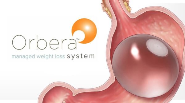 بالون المعدة orbera 2 600x335